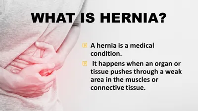Is Laparoscopic Hernia Surgery the Right Choice for You? - Sharvari Hospital Blog