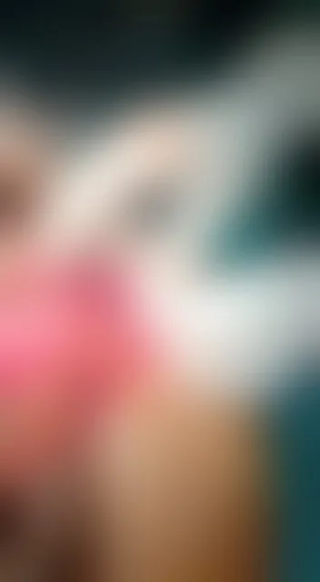 Emergency laparotomy for a strangulated umbilical hernia — the trapped bowel loop released and recovering (clinical video)