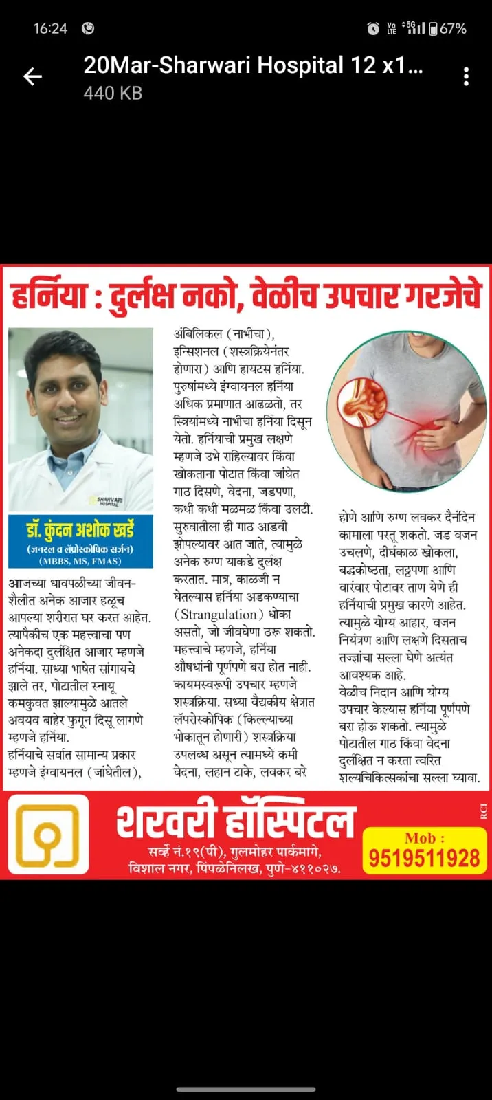 Dr. Kundan Kharde's Lokmat article on hernia treatment