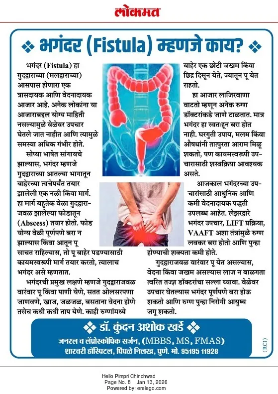 Dr. Kundan Kharde's Lokmat article on anal fistula