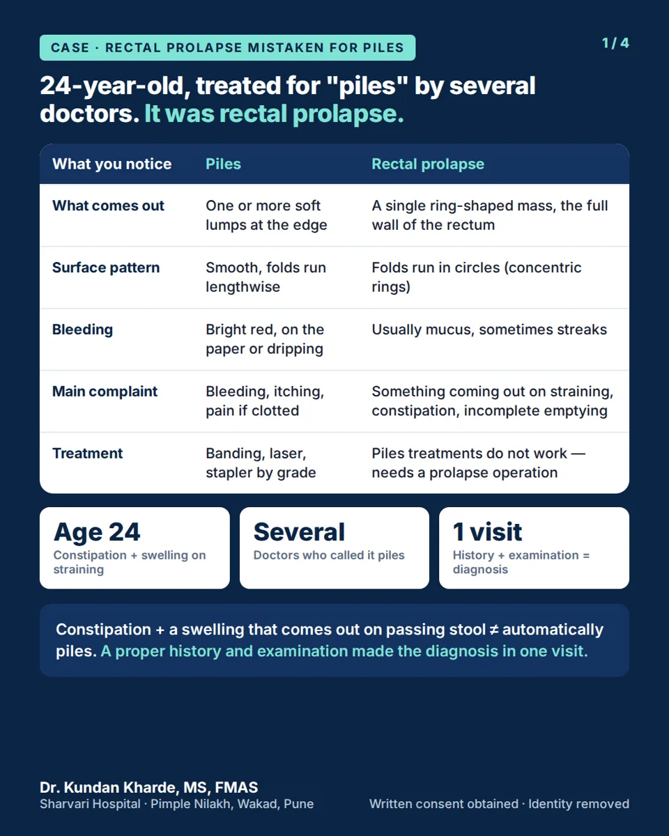 Piles or Rectal Prolapse? How to Tell the Difference (With a Real Case Treated as Piles for a Year) — featured image, Sharvari Hospital blog