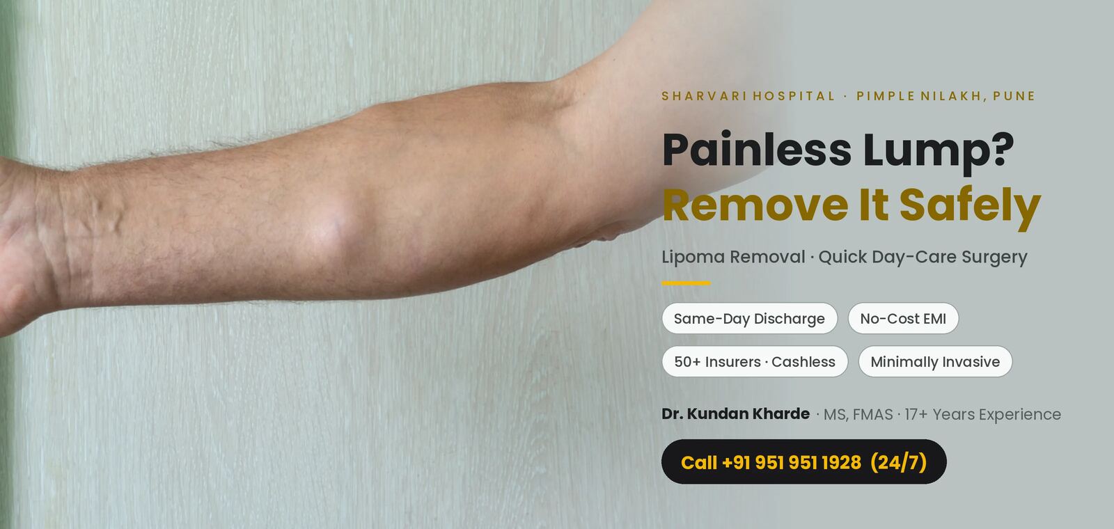 Lipoma lump removal — quick day-care surgery at Sharvari Hospital, Pimple Nilakh, Pune by Dr. Kundan Kharde